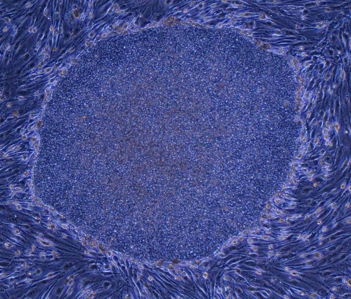 4_Organoids_2007_1440x1228