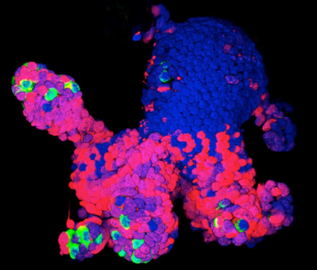 5_Organoids_2011_1440x1228
