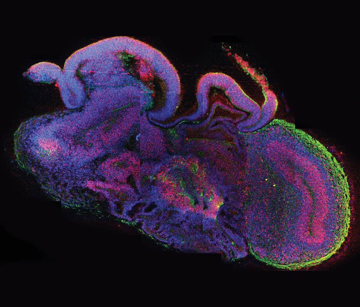 6_Organoids_2012_1440x1228