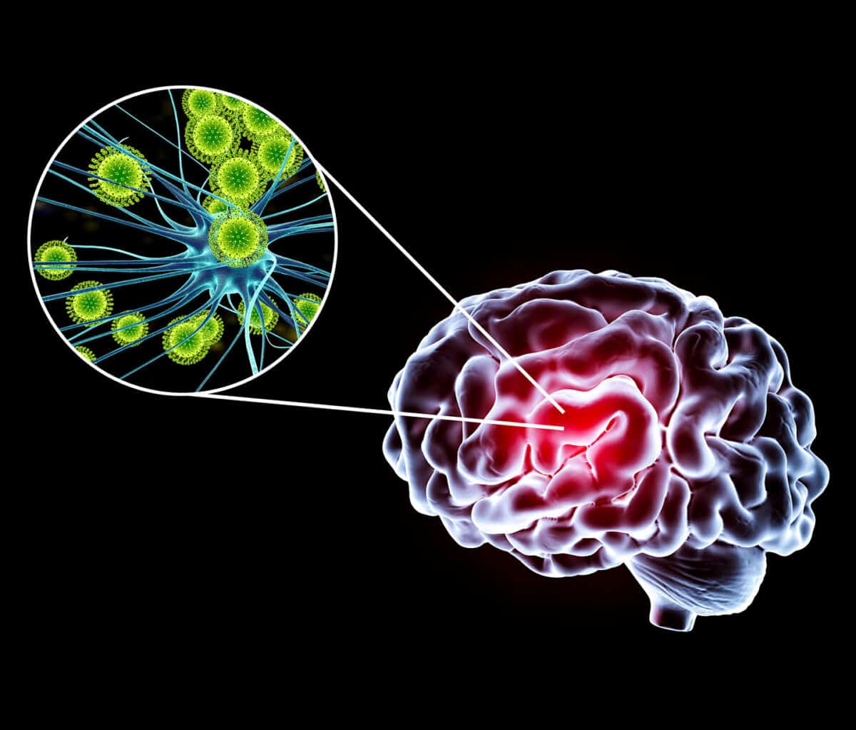 7_Organoids_2015_1440x1228