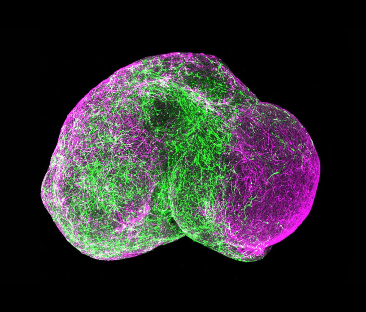 8_Organoids_2016_1440x1228